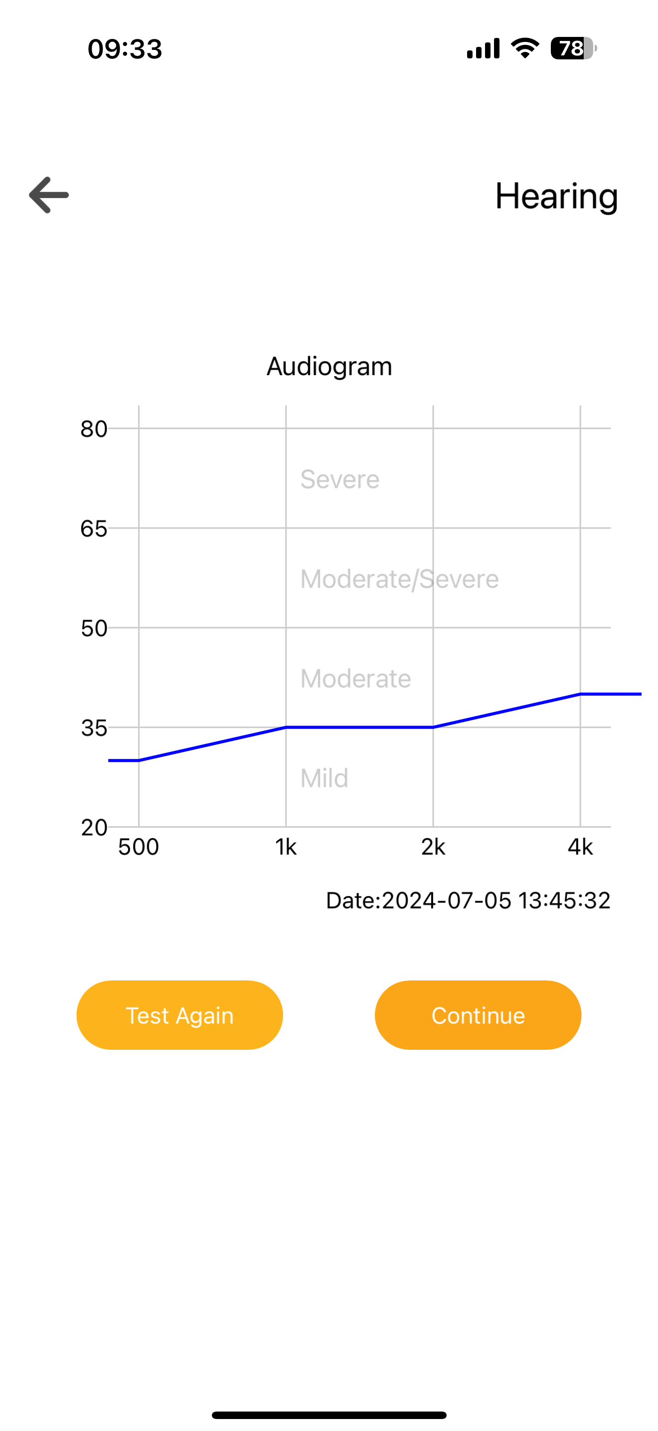 McBly RIC Hearing Aids, E71 (Self Hearing Test and Programed by Phone)